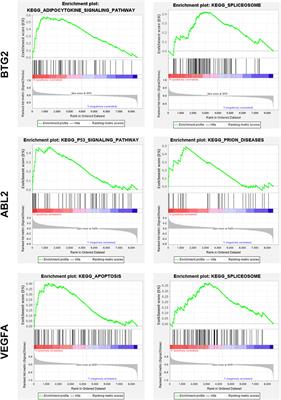 Integrated Analysis of miRNAs and Gene Expression Profiles Reveals Potential Biomarkers for Osteoarthritis